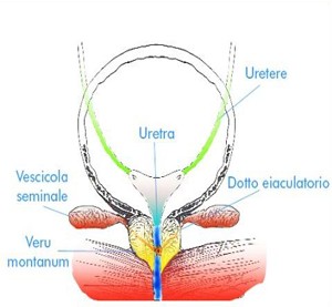 Prostatite